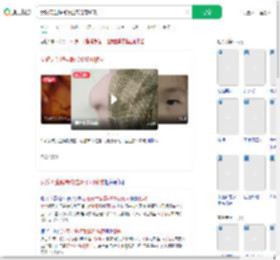女孩天生髌骨脱位双膝可移动_360搜索