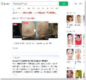 失恋后头发眉毛全部脱落_360搜索